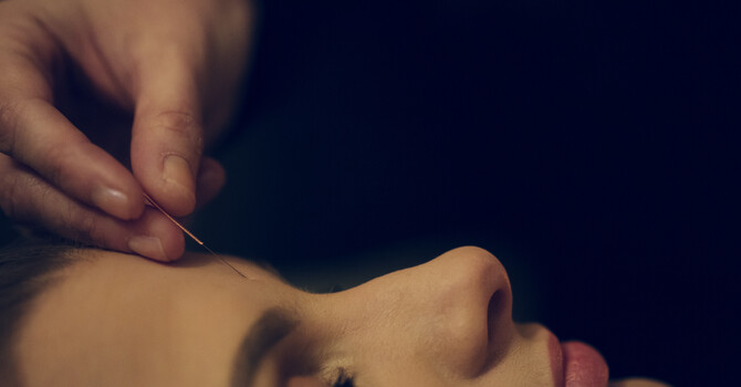 Contemporary Acupuncture